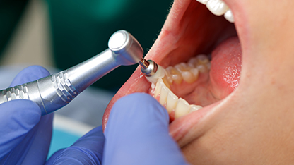 かかりつけ歯科医機能強化型歯科診療所